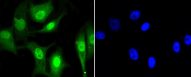 HP1 alpha Antibody in Immunocytochemistry (ICC/IF)