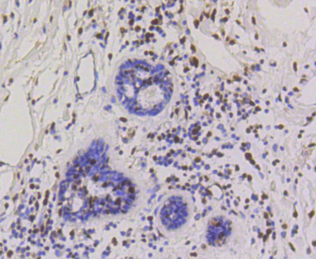 HP1 alpha Antibody in Immunohistochemistry (Paraffin) (IHC (P))