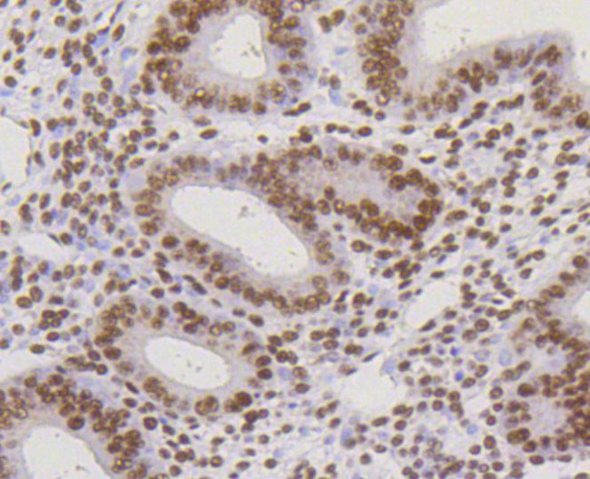 HP1 alpha Antibody in Immunohistochemistry (Paraffin) (IHC (P))