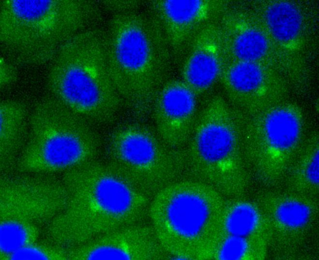 Caveolin 1 Antibody in Immunocytochemistry (ICC/IF)