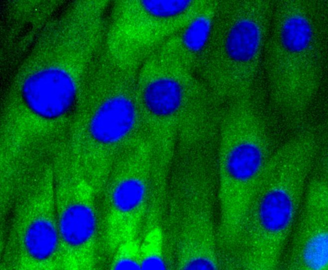 Caveolin 1 Antibody in Immunocytochemistry (ICC/IF)