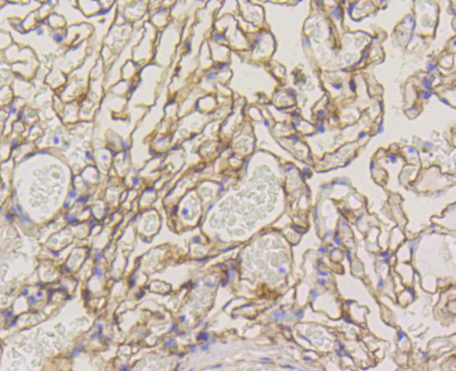 Caveolin 1 Antibody in Immunohistochemistry (Paraffin) (IHC (P))