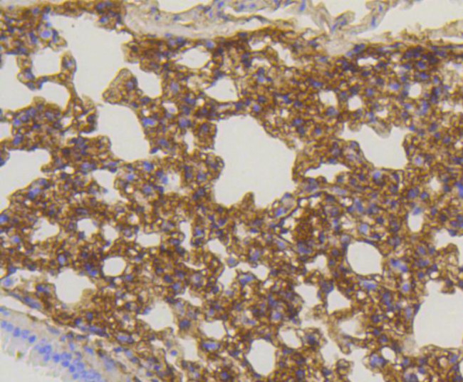 Caveolin 1 Antibody in Immunohistochemistry (Paraffin) (IHC (P))