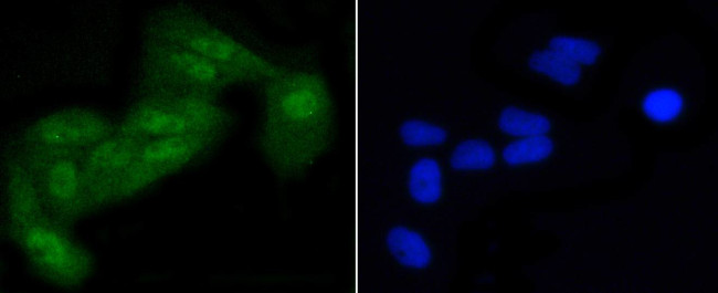 Phospho-EIF2S1 (Ser51) Antibody in Immunocytochemistry (ICC/IF)