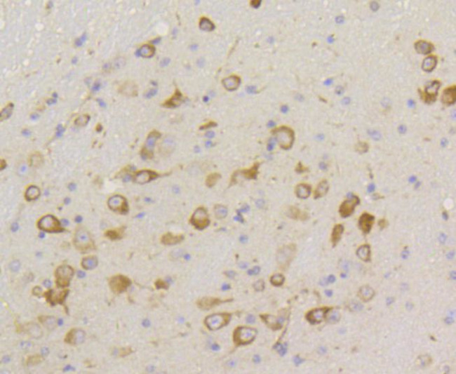 Phospho-EIF2S1 (Ser51) Antibody in Immunohistochemistry (Paraffin) (IHC (P))