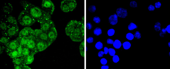 ATF2 Antibody in Immunocytochemistry (ICC/IF)