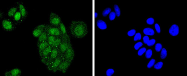 ATF2 Antibody in Immunocytochemistry (ICC/IF)