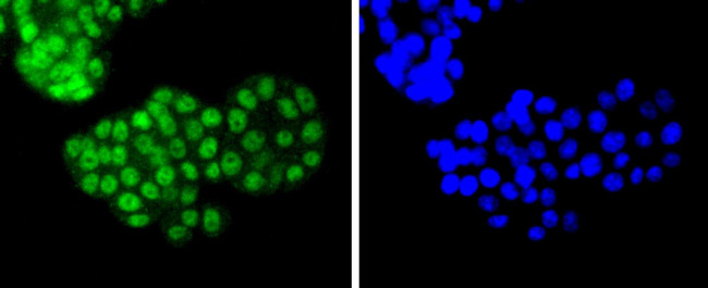 ATF2 Antibody in Immunocytochemistry (ICC/IF)