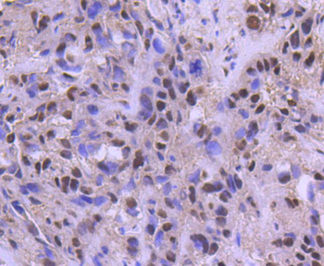 ATF2 Antibody in Immunohistochemistry (Paraffin) (IHC (P))