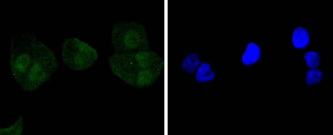 Caspase 8 Antibody in Immunocytochemistry (ICC/IF)