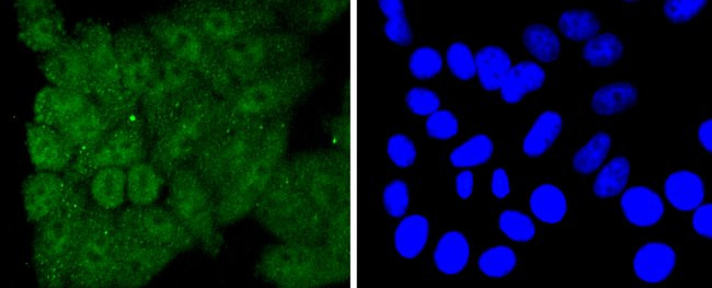 Caspase 8 Antibody in Immunocytochemistry (ICC/IF)