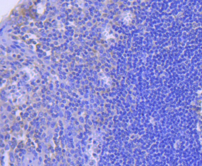 Caspase 8 Antibody in Immunohistochemistry (Paraffin) (IHC (P))