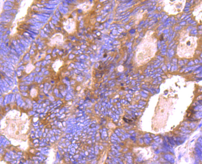 BCL-XL Antibody in Immunohistochemistry (Paraffin) (IHC (P))