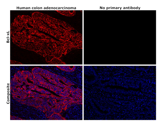 BCL-XL Antibody in Immunohistochemistry (Paraffin) (IHC (P))