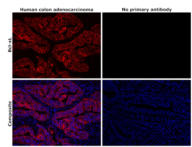 BCL-XL Antibody in Immunohistochemistry (Paraffin) (IHC (P))