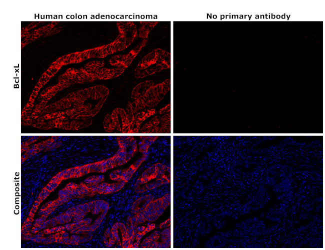 BCL-XL Antibody in Immunohistochemistry (Paraffin) (IHC (P))