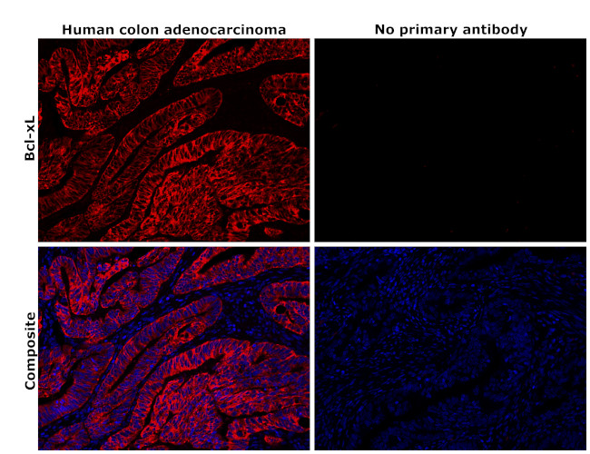 BCL-XL Antibody in Immunohistochemistry (Paraffin) (IHC (P))