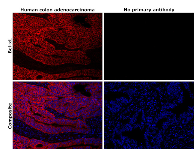 BCL-XL Antibody in Immunohistochemistry (Paraffin) (IHC (P))