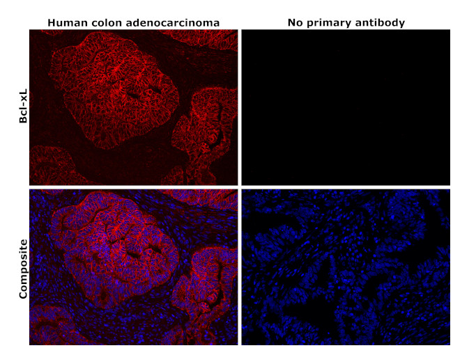 BCL-XL Antibody in Immunohistochemistry (Paraffin) (IHC (P))