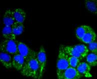 AIF Antibody in Immunocytochemistry (ICC/IF)