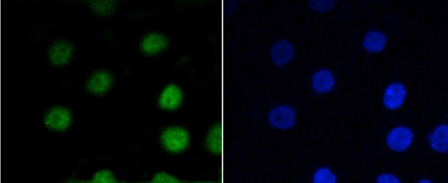 Phospho-Myb (Ser11) Antibody in Immunocytochemistry (ICC/IF)