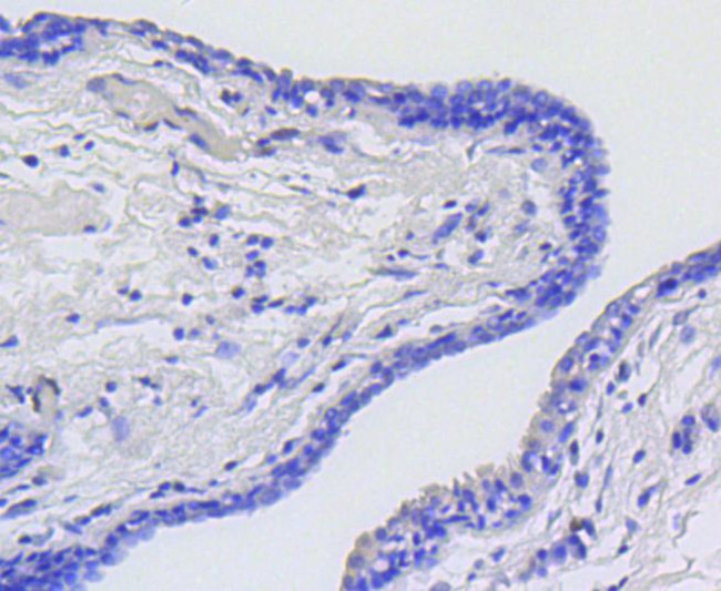 Phospho-Myb (Ser11) Antibody in Immunohistochemistry (Paraffin) (IHC (P))