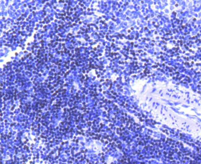 SATB1 Antibody in Immunohistochemistry (Paraffin) (IHC (P))