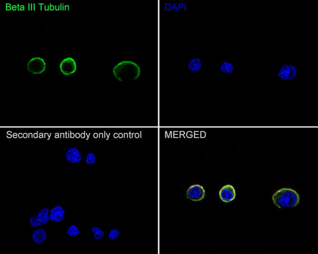 Beta III Tubulin Antibody in Immunocytochemistry (ICC/IF)