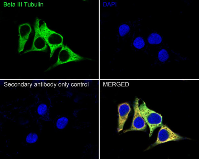 Beta III Tubulin Antibody in Immunocytochemistry (ICC/IF)