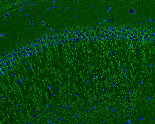 Beta III Tubulin Antibody in Immunohistochemistry (Frozen) (IHC (F))