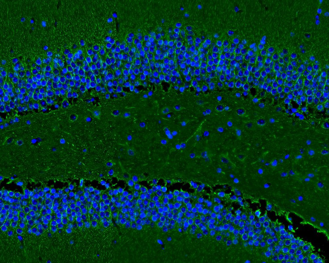 Beta III Tubulin Antibody in Immunohistochemistry (Frozen) (IHC (F))