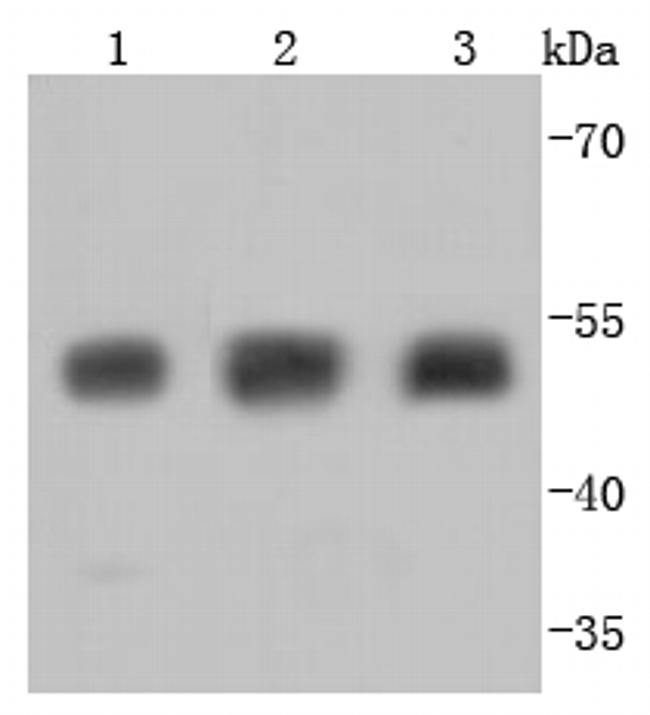 Beta III Tubulin Antibody in Western Blot (WB)