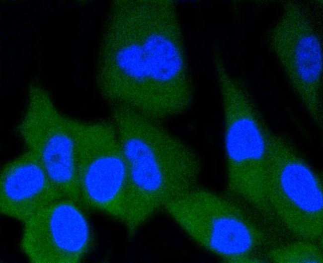 ERG Antibody in Immunocytochemistry (ICC/IF)