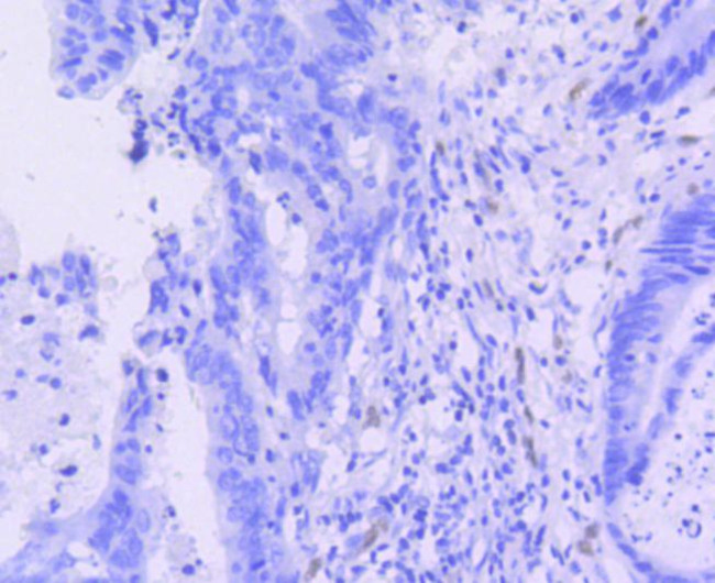 ERG Antibody in Immunohistochemistry (Paraffin) (IHC (P))