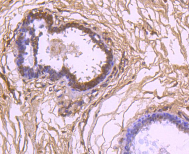 VEGF Antibody in Immunohistochemistry (Paraffin) (IHC (P))