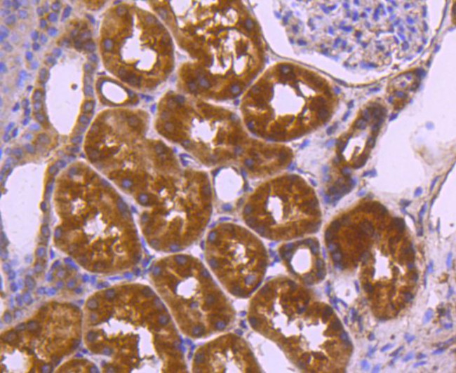 VEGF Antibody in Immunohistochemistry (Paraffin) (IHC (P))