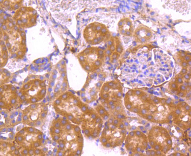 VEGF Antibody in Immunohistochemistry (Paraffin) (IHC (P))