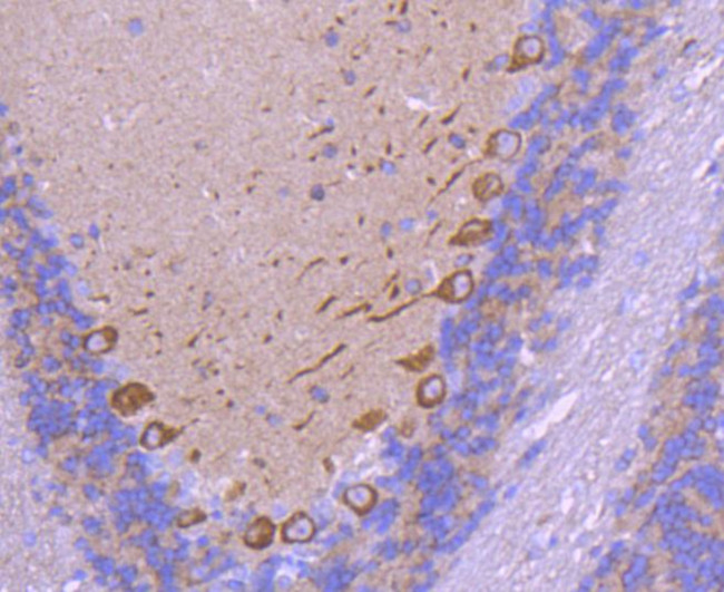 VEGF Antibody in Immunohistochemistry (Paraffin) (IHC (P))