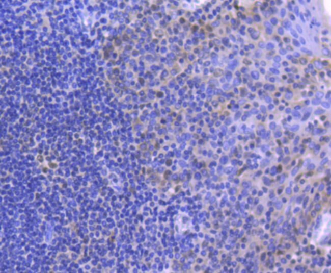MLH1 Antibody in Immunohistochemistry (Paraffin) (IHC (P))