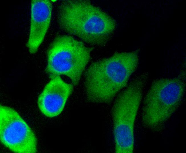 PHD1 Antibody in Immunocytochemistry (ICC/IF)