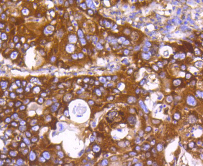 PHD1 Antibody in Immunohistochemistry (Paraffin) (IHC (P))