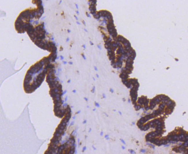 PHD1 Antibody in Immunohistochemistry (Paraffin) (IHC (P))