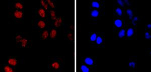 PMS2 Antibody in Immunocytochemistry (ICC/IF)