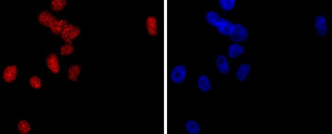 PMS2 Antibody in Immunohistochemistry (Paraffin) (IHC (P))