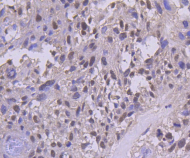 PMS2 Antibody in Immunohistochemistry (Paraffin) (IHC (P))