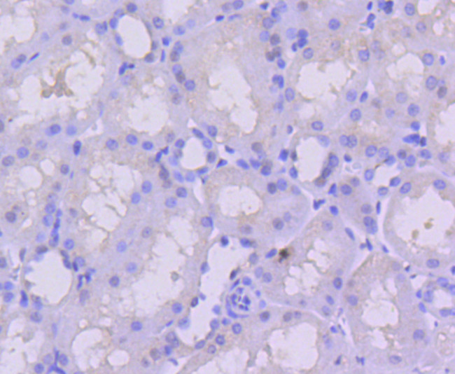 PMS2 Antibody in Immunohistochemistry (Paraffin) (IHC (P))