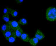 VEGF Receptor 1 Antibody in Immunocytochemistry (ICC/IF)