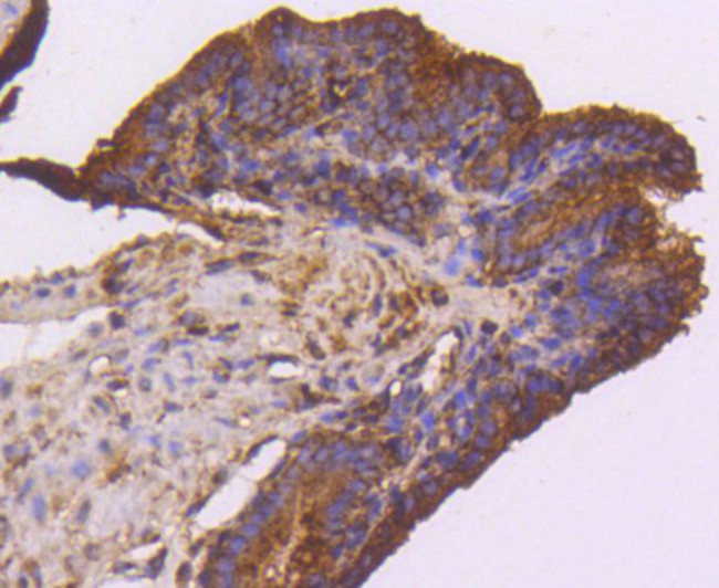 VEGF Receptor 1 Antibody in Immunohistochemistry (Paraffin) (IHC (P))