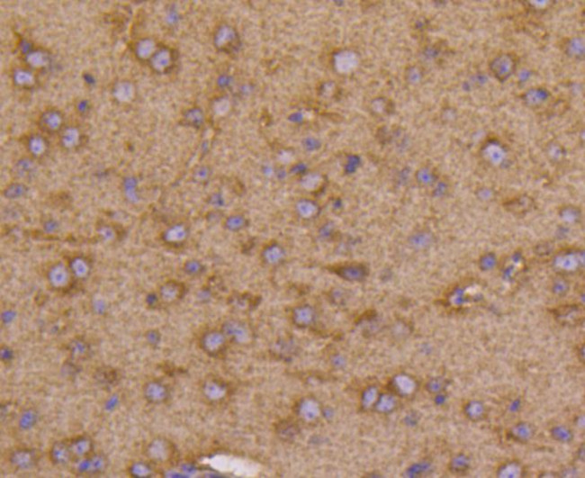 VEGF Receptor 1 Antibody in Immunohistochemistry (Paraffin) (IHC (P))