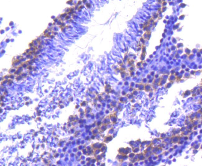 TACC3 Antibody in Immunohistochemistry (Paraffin) (IHC (P))